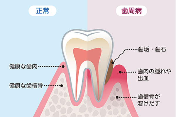 予防メンテナンス