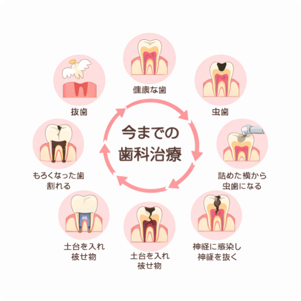 今までの歯科治療