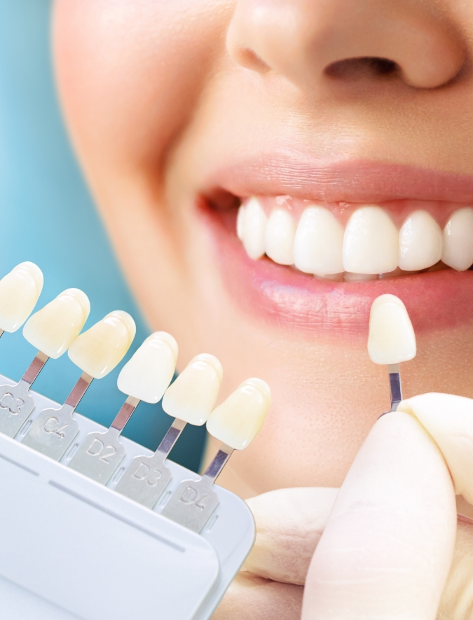 ホワイトニングの特長